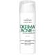 DERMA ACNE+ Matujący krem nawilżający z kwasami AHA - FARMONA PROFESSIONAL